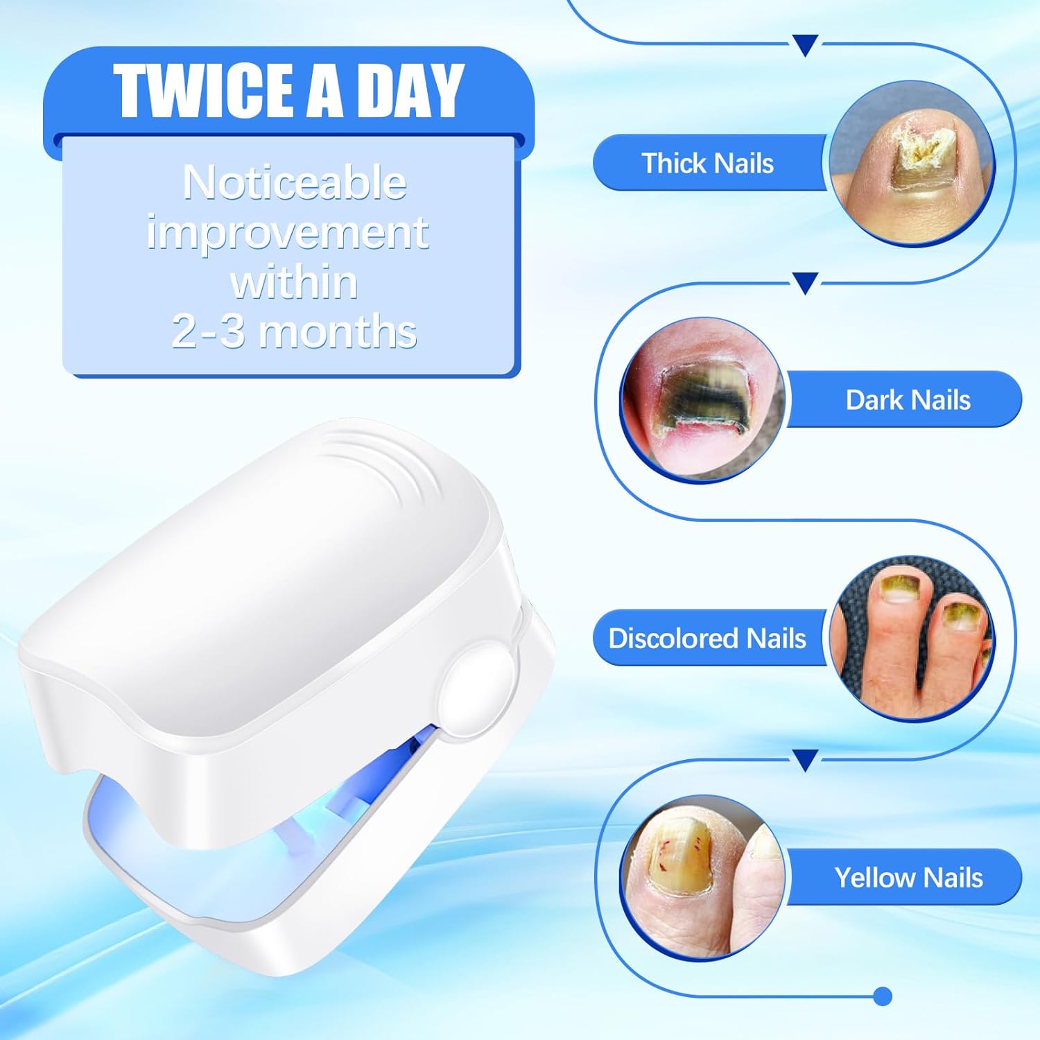 12915 Rechargeable Nail Fungus Treatment for Toenail, Toe Nail Fungal Treatment Nail Fungus Laser Device, Anti-Fungal Nail Treatment for Hand & Feet Infections Remover for Home Use 12915 Rechargeable Nail Fungus Treatment for Toenail, Toe Nail Fungal Treatment Nail Fungus Laser Device, Anti-Fungal Nail Treatment for Hand & Feet Infections Remover for Home Use